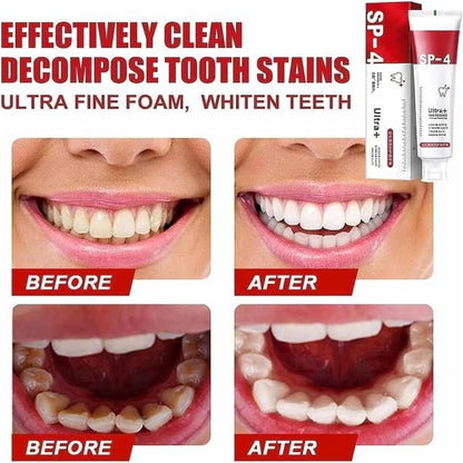 Yayashi SP-4 Ultra Whitening Toothpaste – Probiotic Stain Remover, Gum Protection & Fresh Breath – 120g